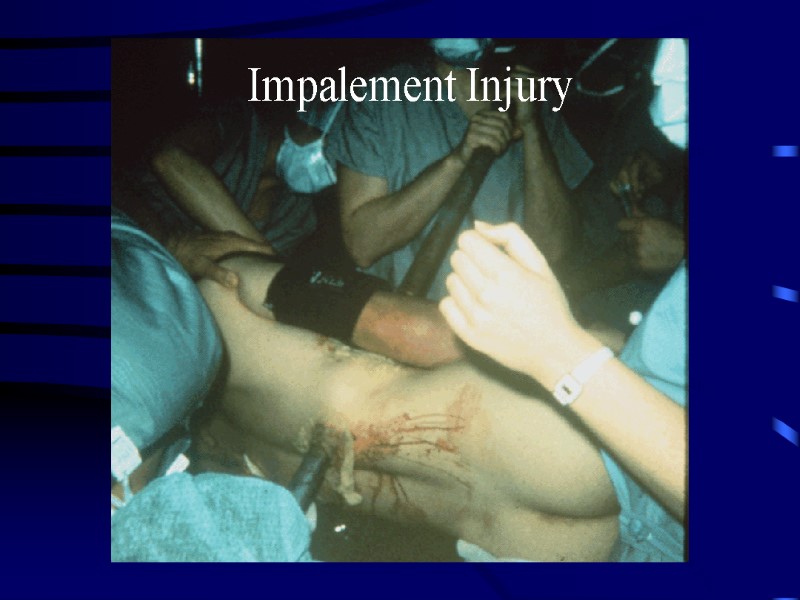 Impalement Injury